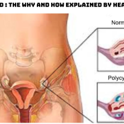 Pcod Heal Max Clinic and research center.