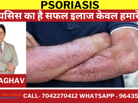 Breaking Down Psoriasis: A Deep Dive into Its Symptoms and Treatment by Heal Max Clinic.